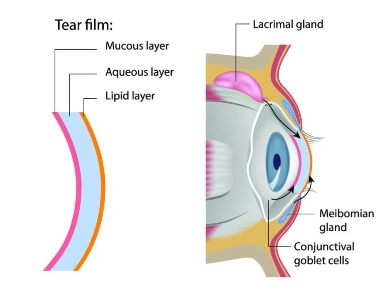 You Don’t Have to Suffer Through Scratchy Dry Eyes: OptiLight Can Help