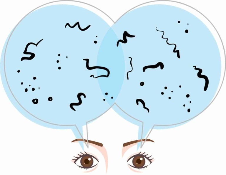 Eye Floaters and When to Seek Treatment?