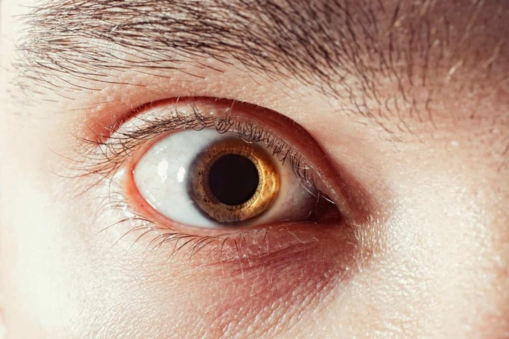 Why Optos Doesn’t Replace Dilation