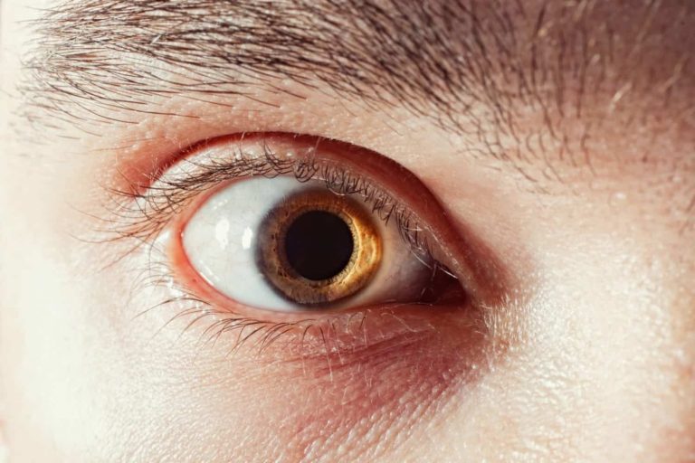 Why Optos Doesn’t Replace Dilation