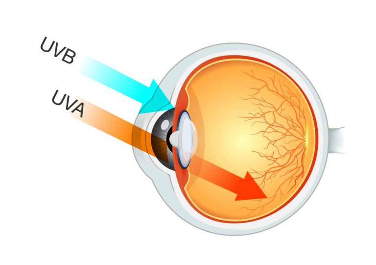 How UVA and UVB Rays from Sun Exposure Damage Your Eyes
